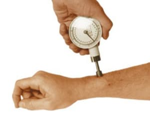 Photo of an analog algometer held by one hand and being pressed into someone’s forearm. The tool is a round white gauge about 5cm wide, with a small piston sticking out of one side of it like a mechanical finger.