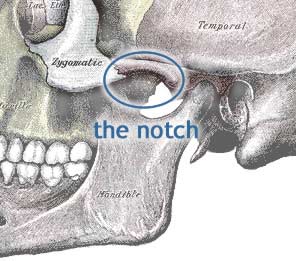 Diagram of the skull, highlighting the location of a common trigger point relative to a bony landmark, a notch on the interior edge of the zygomatic arch (cheekbone).