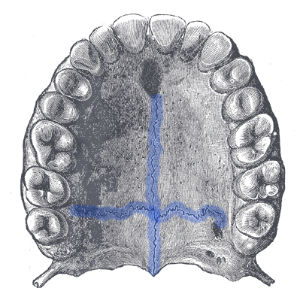 An anatomical illustration of the hard palate viewed from below, showing the bony structure of the roof of the mouth. The image highlights the palatine sutures in blue: the median palatine suture, running front to back along the midline, and the transverse palatine suture, which crosses it horizontally between the palatine processes of the maxilla and the horizontal plates of the palatine bones. Surrounding the sutures are the upper teeth and alveolar ridges, depicted in a classic, vintage medical style.