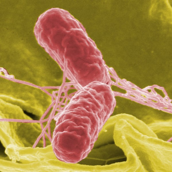 Colour-enhanced scanning electron micrograph showing Salmonella typhimurium (red) invading cultured human cells.