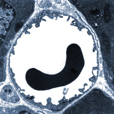 Electron microscope image of a capillary in cross-section, with a red blood cell in it. The capillary is a few micrometres wide.