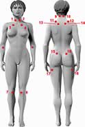 The tender points of fibromyalgia.