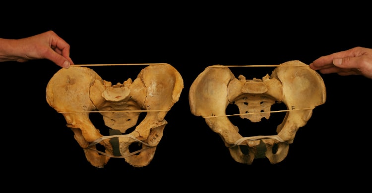 A photo of two pelvic bones held side by side for comparison, highlighting the ilium, ischium, pubis, and sacrum. Elastic bands emphasize alignment and anatomical features, likely for educational purposes, such as demonstrating differences between male and female pelvises or other anatomical variations.