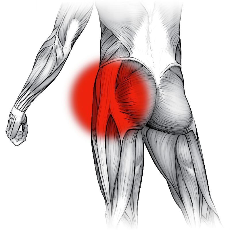 Diagram showing hip pain with strong red highlight on a superficial dissection of a torson hips and thighs.
