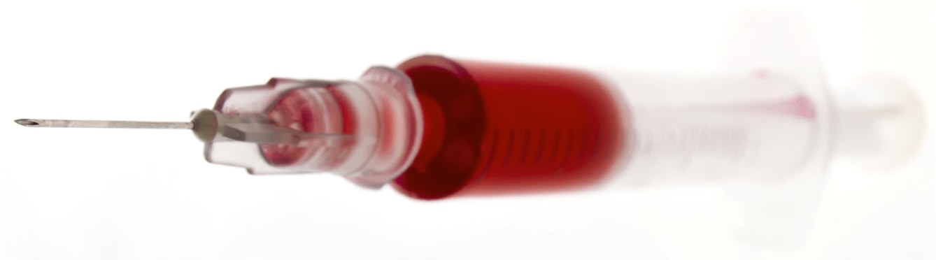 Picture of hyopdermic needle full of blood, representing Platelet-Rich Plasma injection.