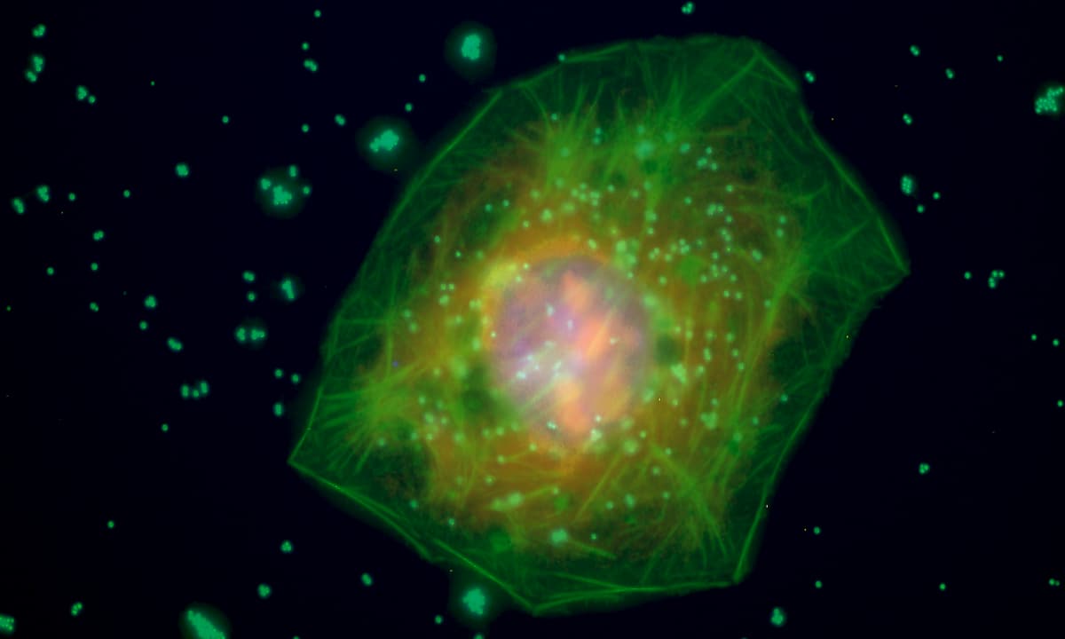 Microscopic image of a liver cell on a mostly black background, speckled with tiny green dots. There are more tiny green dots inside the cell, a few dozen or so. The cell itself is mostly green with an orange nucleus, and prominent green streaks showing the cytoskeleton.