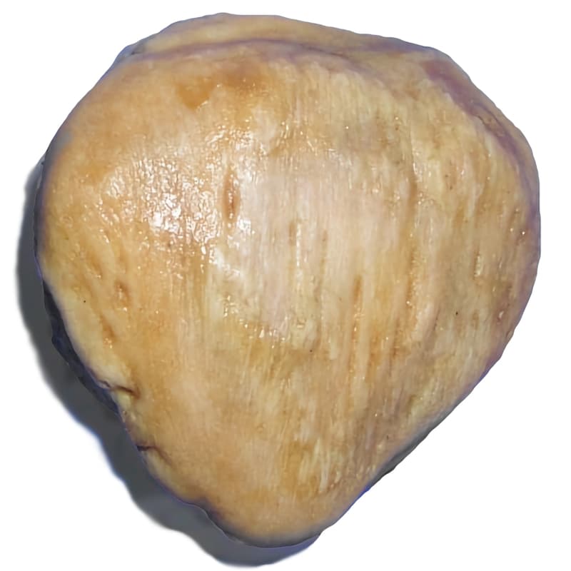 A photograph of the anterior surface of a dissected patella.