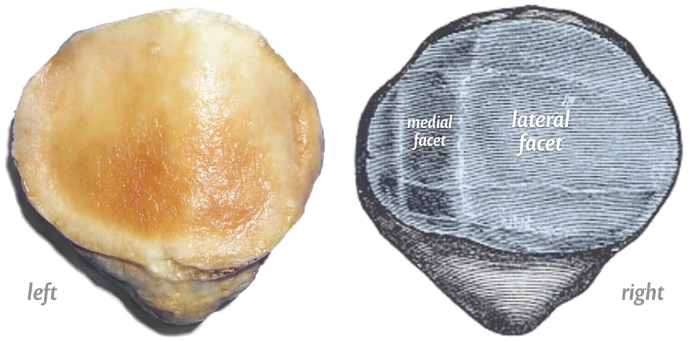 A photograph of the back of a dissected left patella, and an illustrated right patella from Gray’s Anatomy (plate 353) highlighting cartilage in blue. The surface is divided into two zones or “facets,” one larger lateral and another smaller medial. (There’s also the “odd” facet on the innermost edge of the medial facet, not labelled here.)