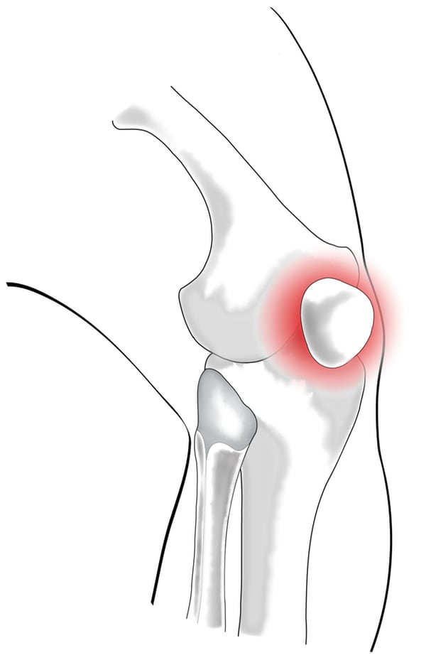 Anatomical illustration of the bones of the knee joint, with dark red highlight of the kneecap itself, and a thick margin around it.