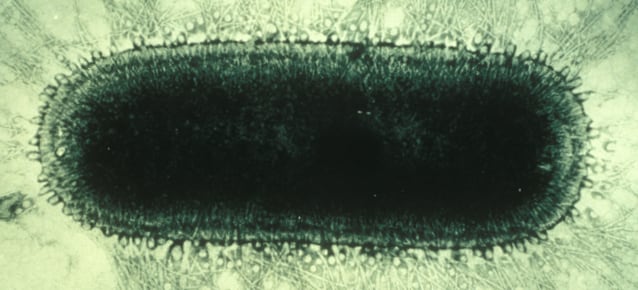 This electron microscope image shows a close-up view of a rabies virus particle. The virus appears as a bullet-shaped structure with a dark, dense core surrounded by a lighter halo, likely representing its nucleoprotein core and outer envelope. The fringed, spiky outer layer is formed by glycoprotein spikes, characteristic of the rabies virus, which it uses to attach to host cells. This striking structure reflects the intricate biology of a virus known for its transmission through animal bites and its impact on the nervous system.