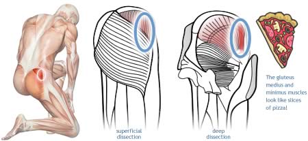 Anatomical diagram showing gluteus minimus and gluteus medius, and their similarity in shape to a slice of pizza. The location of a common gluteal trigger point is shown.