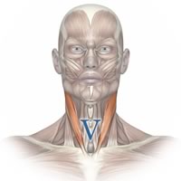 diagram of sternocleidomastoid muscle showing the V-shape the paired muscle makes looking at the front of the neck, with the point of the V at the top of the sternum, and the tips of the V under the ears.