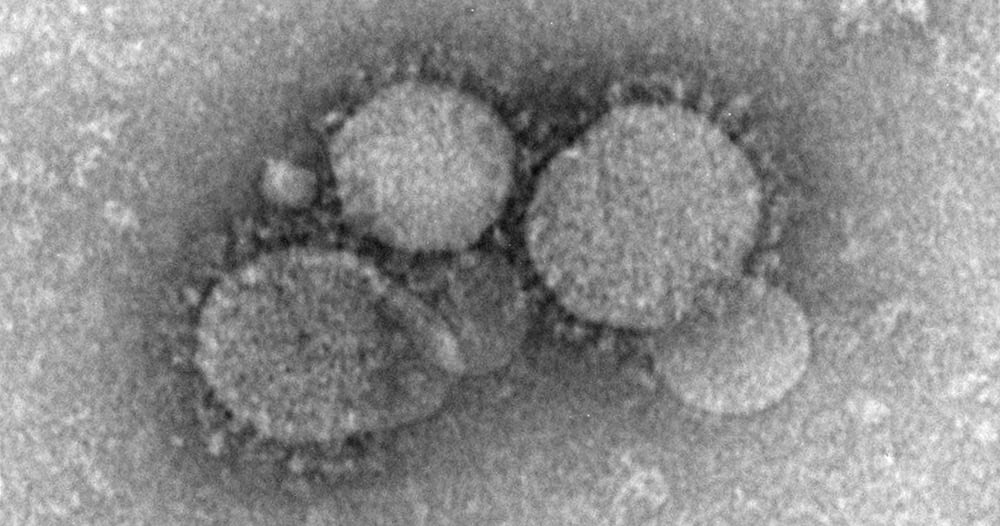 A negative-stained transmission electron microscopic (TEM) image revealed ultrastructural morphology exhibited by the Middle East respiratory syndrome coronavirus (MERS-CoV), which was identified in 2012, as the cause of respiratory illness in people.