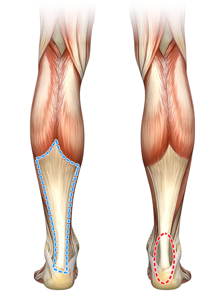 Achilles Tendon Pain: Causes, Diagnosis and Treatment | HSS