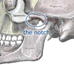 Diagram of the skull, highlighting the location of a common trigger point relative to a bony landmark, a notch on the ingerior edge of the zygomatic arch (cheekbone).