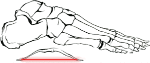 Ink drawing of the bones of the foot, with a bow underneath the arch, and the string of the bow highlighted. The string of the bow is an analogy for the plantar fascia.