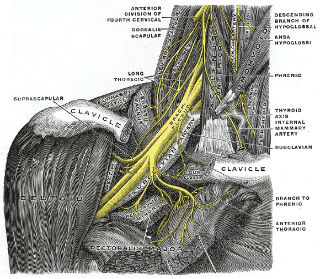 Nerve stretching illustrated by Gray’s Anatomy, plate 808, of the brachial plexus, strongly highlighting the nerves of the brachial plexus in yellow.