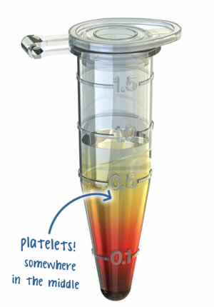 alt:Picture of centrifuged blood in a container, with platelets somewhere in the yellow section in the middle.