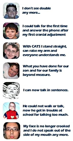 Screenshot of a chiropractic advertisement full of claims. It includes seven photographs of children and babies, each with a short caption. They read as follows: I don’t see double anymore. I can talk for the first time and answer the phone after my first cranial adjustment. With CATS I stand straight, can raise my arm and everyone understands me. What you have done for our son and for our family is beyond measure. I can now talk in sentences. He could not walk or talk, now he gets in trouble at school for talking too much. My face is no longer crooked and I cannot speak a side of my mouth anymore.