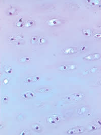 Chondrocytes: the cells that build and maintain cartilage: The sparseness of chondrocytes scattered throughout cartilage mean that your joints are “plagued by inherent limited healing potential.”