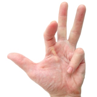 Dupuytren’s contracture is basically “frozen hand.”