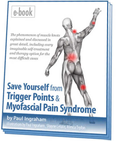 Picture of the cover of my ebook, Save Yourself from Trigger Points and Myofascial Pain Syndrome.