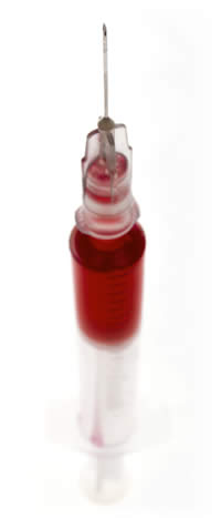 Picture of hyopdermic needle full of blood, representing Platelet-Rich Plasma injection.