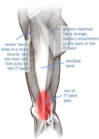 Diagram of iliotibial band anatomy.