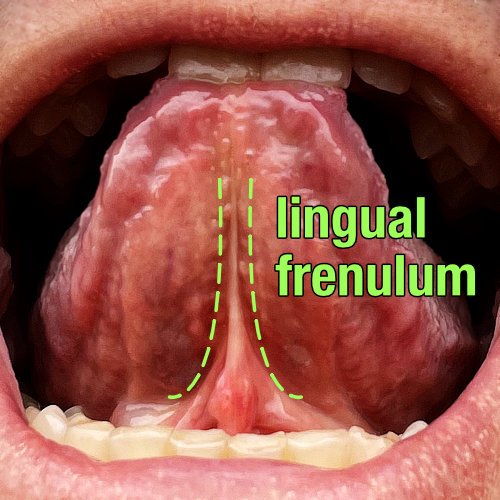 Photograph of the lingual frenulum.