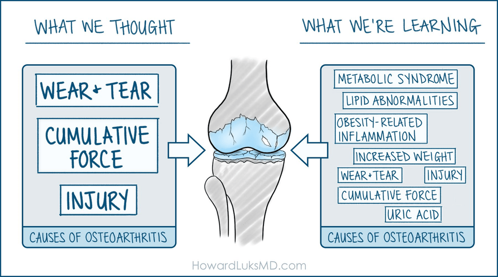 Arthritis is not a wear-and-tear problem