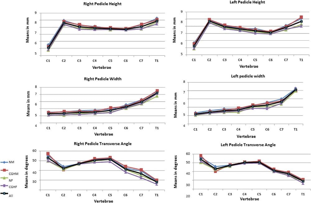 A set of five six graphs, three for the left, and three for the right. Each shows several coloured lines representing three measures of pedicle shape in different populations: men and women, without and without cervicogenic headache. In every graph, the lines overlap so much that they are hard to distinguish from each other.