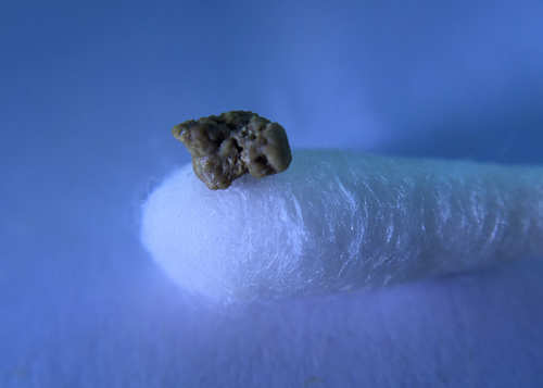 Close-up of my tonsil stone, a grey, craggy little tonsillar calculi resting on a Q-tip.