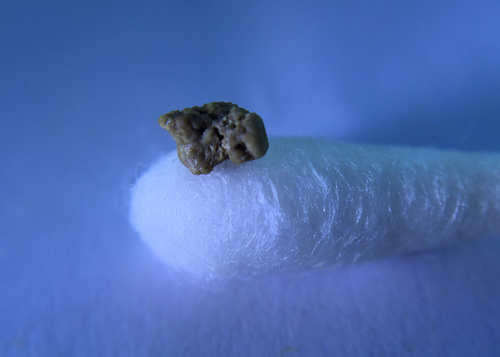 Close-up of my tonsil stone, a grey, craggy little tonsillar calculi resting on a Q-tip.