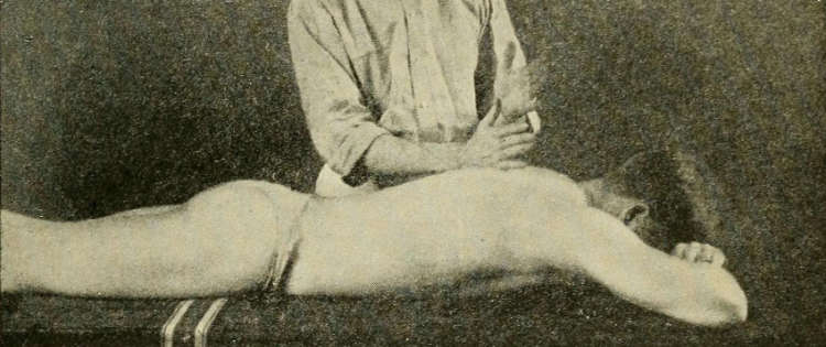 Vintage photo of Swedish massage. A male masseuse is hitting a prone man’s back with “karate hands,” a technique known as “tapotement.”