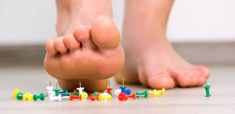 Picture of a foot about to step on a pile of colourful tacks, representing the pain of plantar fasciitis.
