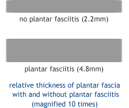 Thick on sale plantar fascia