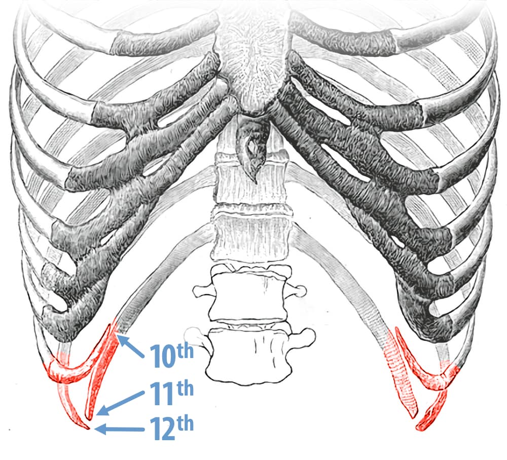 Vintage anatomical diagram of the back of a ribcage from the classic Gray’s Anatomy text, which still the only decent source of public domain anatomical illustrations. This diagram shows only the lower half the ribcage, and has my labelling, pointing out the tips of three floating ribs, not just two, which are also highlighted in red to suggest some potential for discomfort.