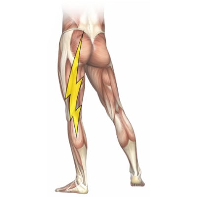 Miracle stretch for 2025 sciatica