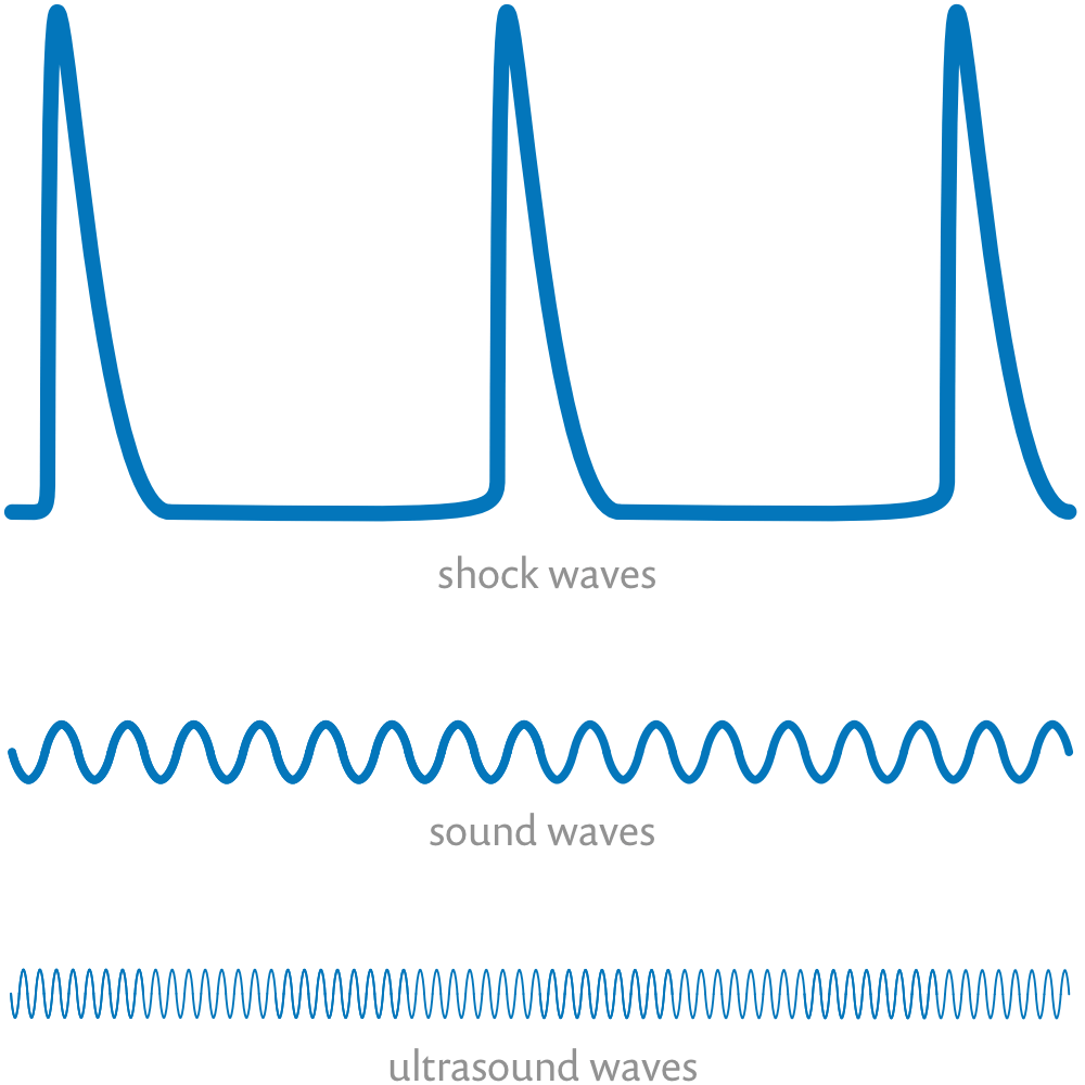 A simple diagram showing three kinds of graphed pressure waves labelled “shock waves,” “sound waves,” and “ultrasound waves.” There are just three shock waves, and they are much taller and sharper than the sound or ultrasound waves, and well-separated by a flat line. There are a couple dozen much shorter, rounder sound waves. And then the ultrasound waves look the same as the sound waves, but there are many dozens more of them compressed into the same space.