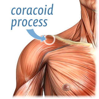 Anatomical illustration showing the location of the coracoid process on a superficial dissection of the shoulder.