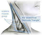 Diagram of anterior triangle of the neck, a region of intriguing musculature, specially the scalene muscle group with its common and clinically significant myofascial trigger points. The triangle is the area between the sternocleidomastoid, clavicle, and trapezius muscles.