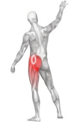 Anatomical diagram, a superfical dissection of a man, with a spot circled at the top of his left hip, with red colouring representing trigger point referral spreading down the side and back of his thigh to the knee.