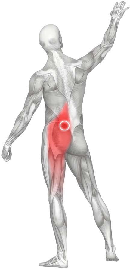 Lower Back Trigger Points - A Key To Lower Back Pain Relief