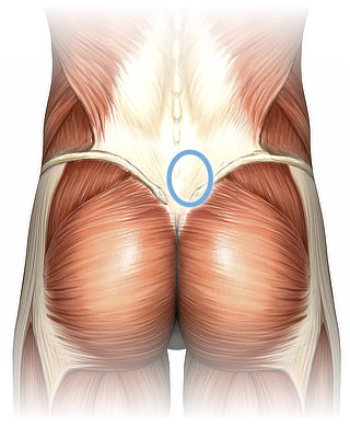 Anatomy of the lower back, superficial dissection, with a blue circle in the low right back, highlighting the recommended location for massage (described in detail below).