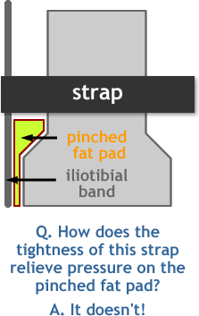 Complex schematic of how ITBS straps supposedly work.