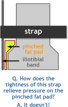 Do IT Band Straps Work for Runner's Knee?