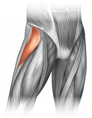 Illustration of the tensor fascia latae muscle, showing it highlighted on a shallow dissection of a torso from navel to knees.