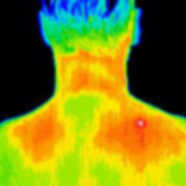 Small thermograph of a trigger point hot spot on the back of a man’s shoulder.