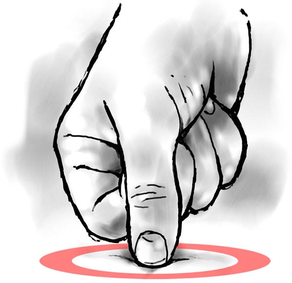 Small illustration of a thumb pressing downwards on a myofascial trigger point.