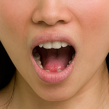Close-up photo of a wide open mouth.